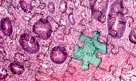 A picture of a pathology image as a jigsaw puzzle, missing a piece