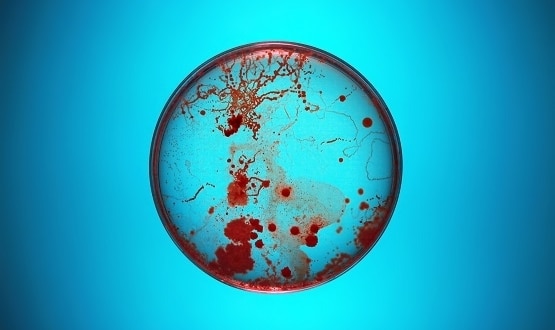 A petri dish containing bacteria