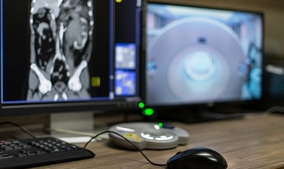 A desktop computer displays a CT scan on its monitor