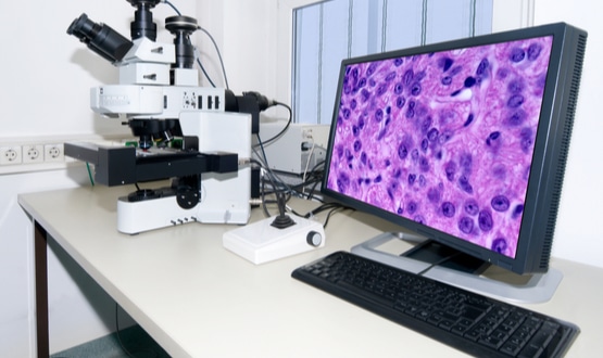 Developing the real business case for digital pathology