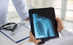 NICE recommends use of AI to detect broken bones on X-rays