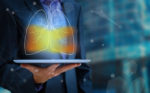 AI to help detect lung cancer faster deployed in Greater Manchester